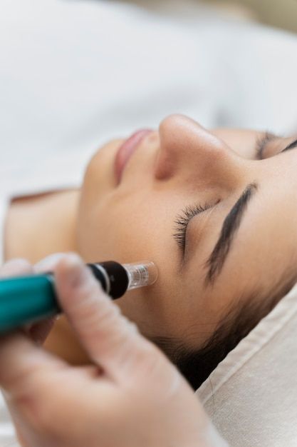 Facial de Microagujas | Depósito $25 | Precio $125